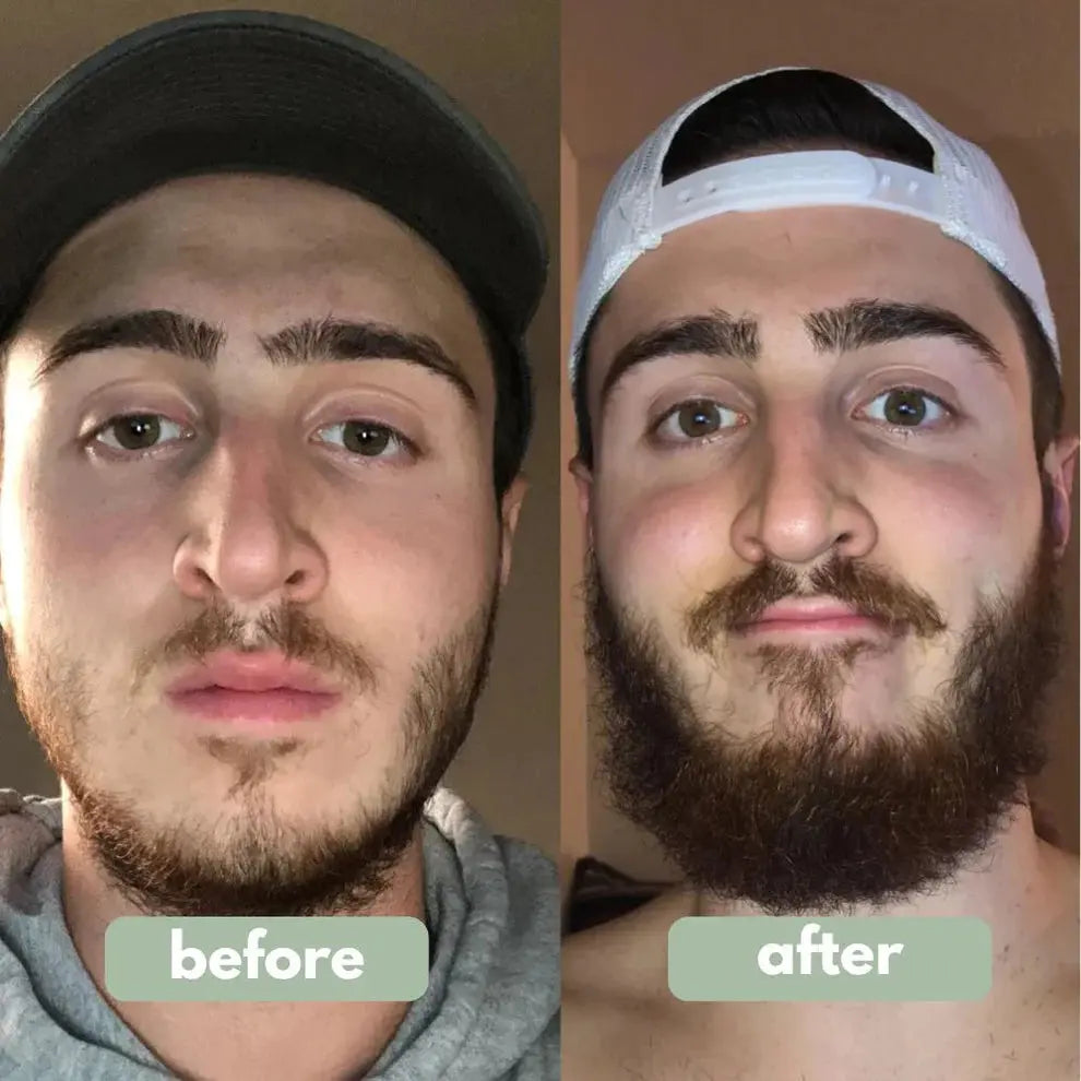 Norvantar - Hair Growth Serum Norvantar