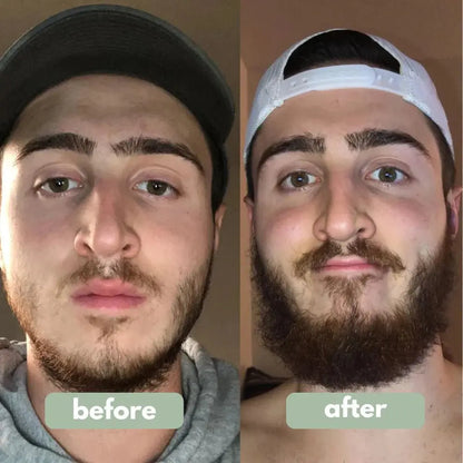 Norvantar - Hair Growth Serum Norvantar