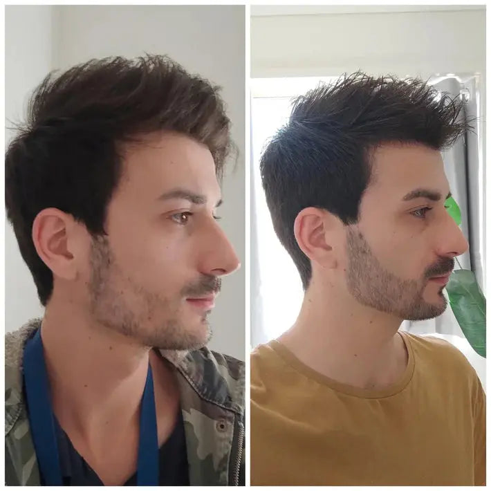 Norvantar - Hair Growth Serum Norvantar